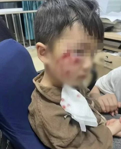 被瘋?cè)麤](méi)有“救命藥”，怎么辦？